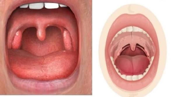 Phân biệt hình ảnh họng bình thường - Nhà thuốc FPT Long Châu