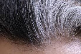 Also, an abnormal pituitary gland or thyroid gland can cause hair to turn gray. Causes Of Baldness Gray Hair Identified