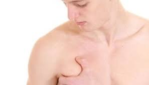 One study found that male breast cancer is on the rise, with a 25% increase over the 25 years from 1973 to 1988. Male Gene Teaches Us About Breast Cancer