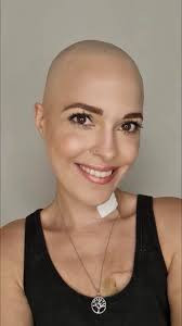 Charelle's Journey with Hodgkins Lymphoma