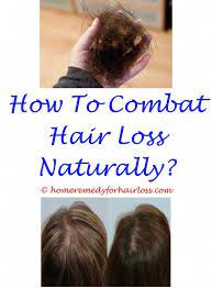 How to reverse hair loss after surgery. Hair Loss After Operation Does Having Long Hair Cause Hair Loss Yahoo Advantix For Cats Hair Los Vitamins For Hair Loss Hair Loss Shampoo Hair Loss Treatment