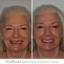 John Paul Gallardo, DDS, PA (@gallardoperiodontics) • Instagram photos and  videos