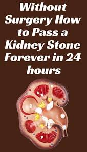 Without Surgery How To Pass A Kidney Stone Forever In 24 Hours Natural Cough Remedies Kidney Stones Remedy Natural Remedies For Heartburn