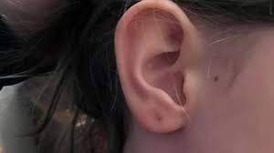 Mom Says Teacher Re Pierced Kid S Ears Abc7 New York
