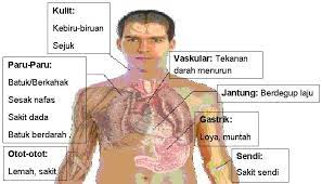 Infeksi akut pada paru bincang sehati. Pneumonia Paru Paru Berair Posts Facebook