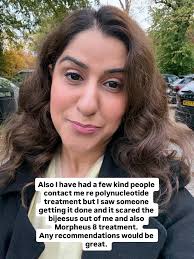 You all know I'm quite open where it comes to things like health and the  ageing process so I have noticed all of a sudden these little puffy bags  that appear under