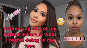 Why You're swollen after Cheek fillers, The Side Effects of Dermal Fillers 