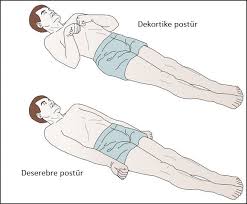 Deserebre Ve Dekortike Posturler Blogger Photo And Video