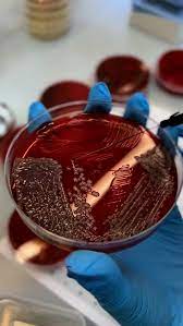 🔬Proteus mirabilis- грамнегативна бактерія, яка часто асоціюється з інфекціями сечовивідних шляхів, особливо у пацієнтів із тривалою катетеризацією. 🔬Proteus mirabilis дуже легко та ефективно колонізує сечовивідні шляхи. Цей рух полегшується ...