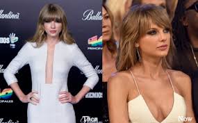 This surgery is referred to as lip filler surgery and the way the lips are looking plump is due to lip injections and dermal filler. Taylor Swift Boob Job 2017