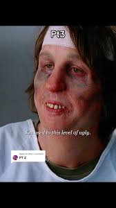 Nip Tuck: Treacher Collins Surgery Scene Explained