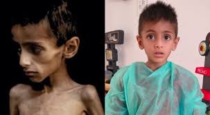 BBC World Service uses two-month-old photo to promote a narrative < CAMERA  UK