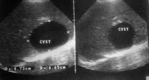 We did not find results for: Diagnosis Of Hydatid Disease Of The Liver Springerlink