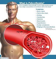 Pin On Blood Disorders