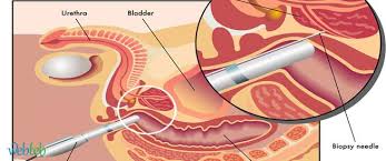 يعد إشباع الرغبة الجنسية من أهم المتطلبات البشرية التي نسعى دوماً لتحقيقها بشكل أو بآخر، فالبعض يمارس الجنس والبعض الآخر يكتفي بالاستمناء، لكن بالنسبة للذكور هل. Ø§ÙØ¶Ù„ Ø§Ù„Ø·Ø±Ù‚ Ù„Ø¹Ù„Ø§Ø¬ ÙˆØ¥Ø³ØªØ¦ØµØ§Ù„ Ø§Ù„Ø¨Ø±ÙˆØ³ØªØ§ØªØ§ ÙˆÙŠØ¨ Ø·Ø¨