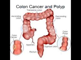 Pin On Cancer