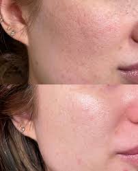 Здравствуйте, интересуют аниматоры для детей или костюм фенячего патруля