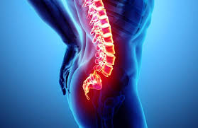 Kokzygodynie Symptome Ursachen Und Therapie Heilpraxis