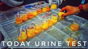 As i did nothing wrong i just followed every instructions they give. Cara Clearkan Urine Ketum
