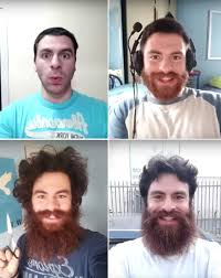 How fast your hair grows. 45 Second Timelapse Of A Man S Beard And Hair Growth Over A Year Geekologie