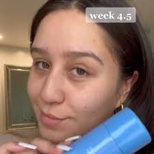 Amazon.com: Dermalogica Daily Milkfoliant, Face Exfoliator, Powder Scrub  Exfoliant with AHA and BHA