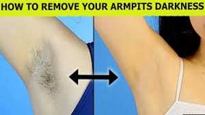 Home remedies to permanently remove armpit hair at home removing unwanted hair at home might be a very good decision, since you might decide what ingredients. How To Remove Armpits Hair Permanently Remove Unwanted Body Hair White Remove Armpit Hair Bikini Hair Removal Hair Removal