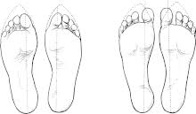 Is there a relationship between lumbar curvature and high heels? High Heeled Shoe Wikipedia