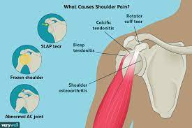 Tendons are strong bands of tissue that connect muscles to your bones. Shoulder Pain Causes Treatment And When To See A Doctor