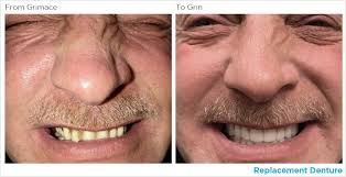 With denture before and after pictures, you see that no situation is hopeless. Dds Dentures And Implant Solutions Klrt Fox16 Com