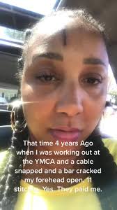 Gym Machine Cable Breaks and Criticly Injures Man