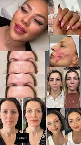 Aesthetic procedures in Alanya city center