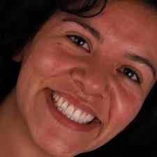 Hace 4 años , ya realizabamos casos en otro nivel 👑👑👑👑👑👑🇲🇽🦷 Qué  les parece uno de mis casos preferidos?