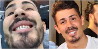 Se inscrevam no canal e ativam o sininho para receber mas vídeos e deixe seu super like para ajudar o canal a crescer Video Humorista Carlinhos Maia Mostra Os Dentes Sem A Lente De Contato E Imagem Assusta