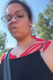 Wie eine junge Frau aus Leopoldshafen 20 Jahre mit Fehldiagnosen lebt