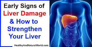 Here Are The First Signs Of Liver Disease Don T Ignore Them Liver Disease Liver Liver Care