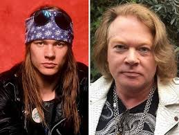 Axl Rose's Cosmetic Surgery: The Transformation of a Rock Legend