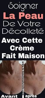 Soigner La Peau De Votre Decollete Avec Cette Creme Fait Maison Decollete Healthy Beauty Make Beauty Beauty Hacks