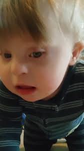 Down Syndrome Walk Baxckwards