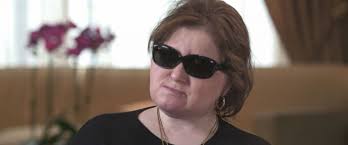 Youngest US face transplant recipient shares story of suicide survival and  hope: 'Life is an amazing gift'