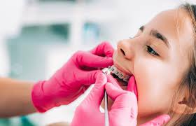 घर पर कैसे काटें ब्रेसेस की तार? Braces Emergency What To Do When Brackets Or Wires Break