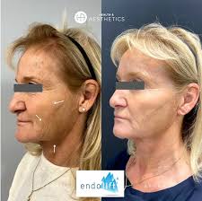 Dr Rekha Tailor's best treatments for over 60's