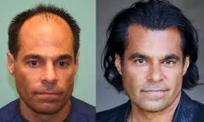 SARA WASSERBAUER, MD