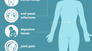 Sicca Syndrome Causes