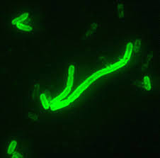 Their status as pests is usually a function of abundance, distribution, or density. Plague Disease Wikipedia
