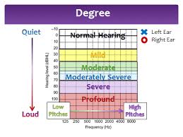 Understanding The Audiogram Arizona Hearing Specialists