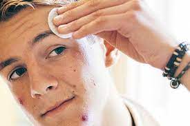 Clear your skin with her free report, 10 scientifically backed foods to help clear your acne by clicking here to sign up. How Long Does It Take For Skin To Clear Up Skin Care Geeks