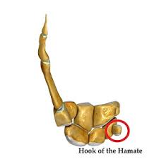 Image result for Hamate Bone