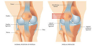 Image result for Patella Tracking Assessment