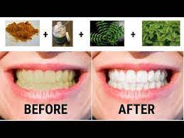 Pin On Rejuvenescence