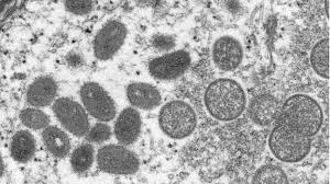 Monkeypox does not spread easily between people, but it's possible to catch it from: Jw2fkweqbze Om